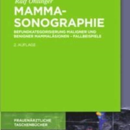 Mammasonographie