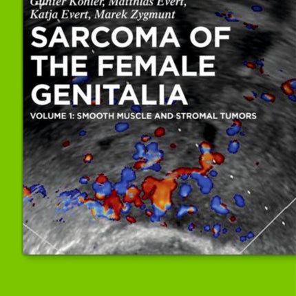 Smooth muscle and stromal tumors and prevention