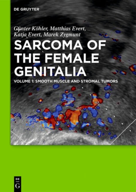 Smooth muscle and stromal tumors and prevention