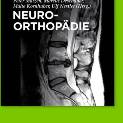 Neuroorthopädie