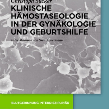 Klinische Hämostaseologie in der Gynäkologie und Geburtshilfe