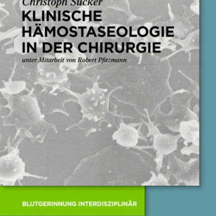 Klinische Hämostaseologie in der Chirurgie