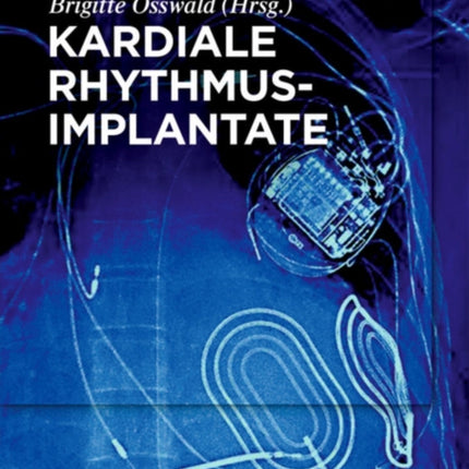 Kardiale Rhythmusimplantate