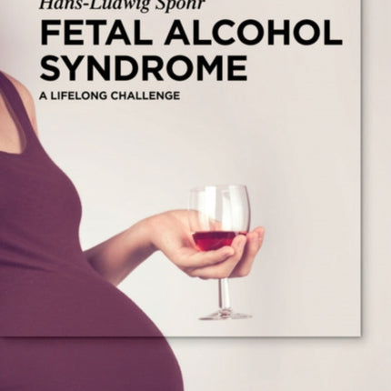 Fetal Alcohol Syndrome: A lifelong Challenge