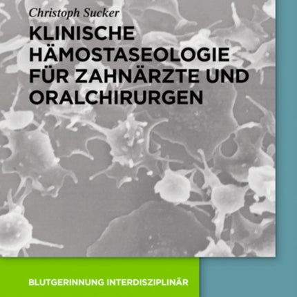 Klinische Hämostaseologie für Zahnärzte und Oralchirurgen