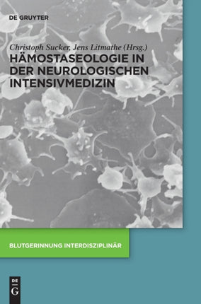 Hämostaseologie in der neurologischen