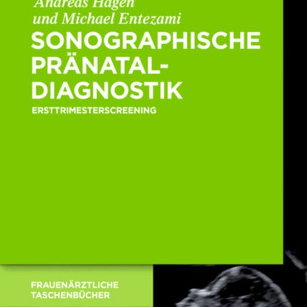 Sonographische Pränataldiagnostik
