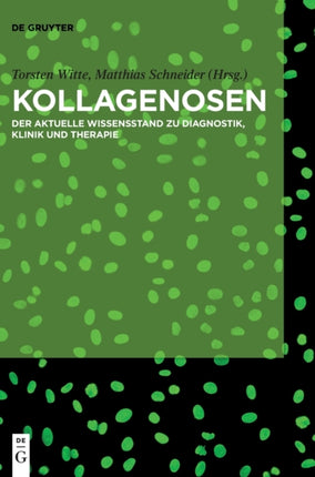 Kollagenosen: Der Aktuelle Wissensstand Zu Diagnostik, Klinik Und Therapie