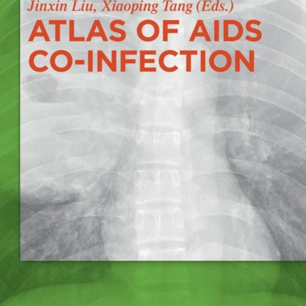 Atlas of AIDS Co-infection
