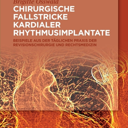 Chirurgische Fallstricke kardialer Rhythmusimplantate