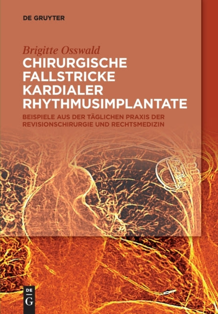 Chirurgische Fallstricke kardialer Rhythmusimplantate