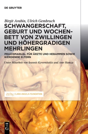 Schwangerschaft, Geburt und Wochenbett von Zwillingen und höhergradigen Mehrlingen