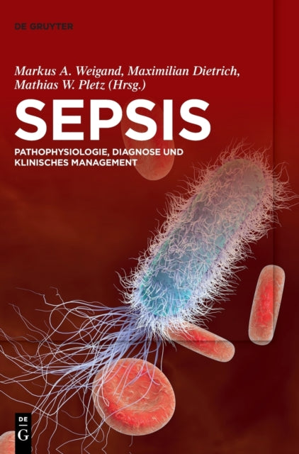 Sepsis