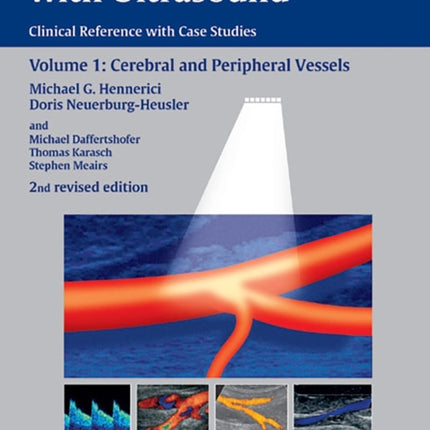 Vascular Diagnosis with Ultrasound: Clinical Reference with Case Studies Volume 1: Cerebral and Peripheral Vessels