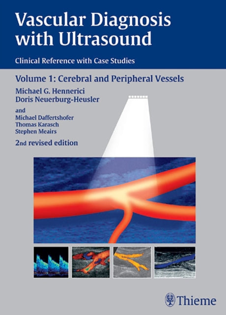 Vascular Diagnosis with Ultrasound: Clinical Reference with Case Studies Volume 1: Cerebral and Peripheral Vessels