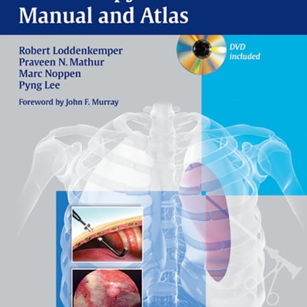 Medical Thoracoscopy / Pleuroscopy: Manual and Atlas