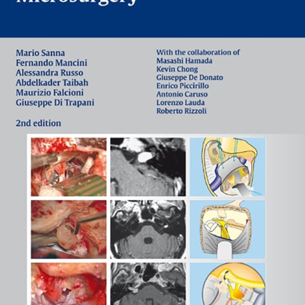 Atlas of Acoustic Neurinoma Microsurgery