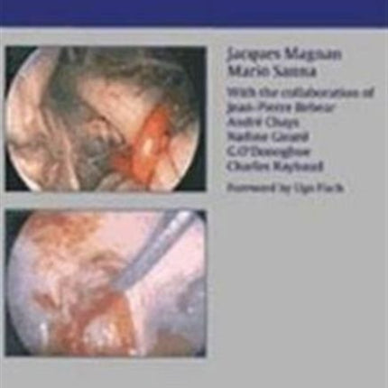 Endoscopy in Neuro-Otology and Skull Base Surgery (AT)