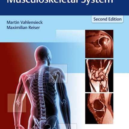 MRI of the Musculoskeletal System