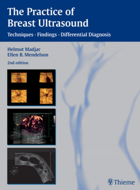 The Practice of Breast Ultrasound: Techniques, Findings, Differential Diagnosis