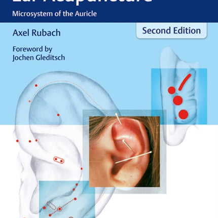 Principles of Ear Acupuncture: Microsystem of the Auricle