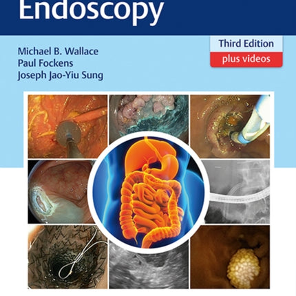 Gastroenterological Endoscopy