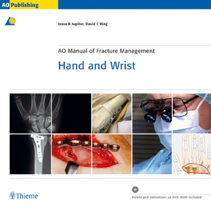 AO Manual of Fracture Management  Hand and Wrist