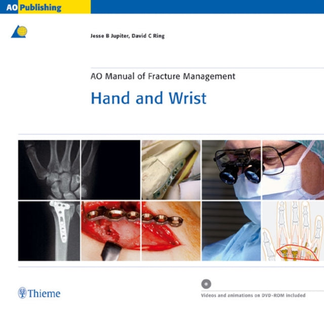 AO Manual of Fracture Management  Hand and Wrist