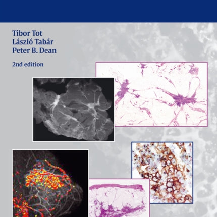 Practical Breast Pathology
