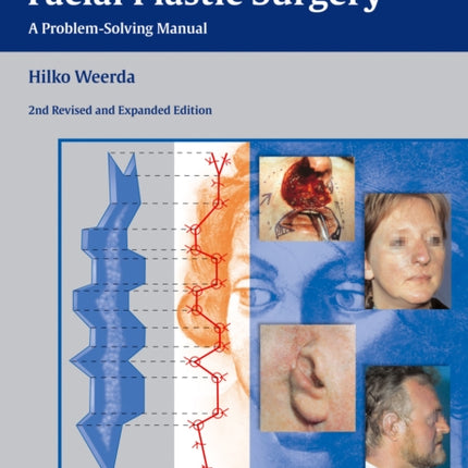 Reconstructive Facial Plastic Surgery: A Problem-Solving Manual