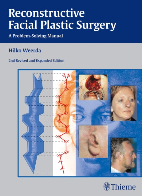 Reconstructive Facial Plastic Surgery: A Problem-Solving Manual