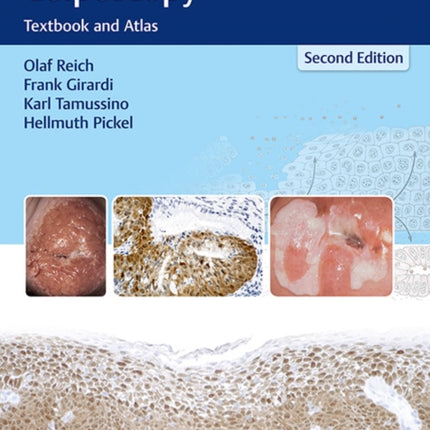 Burghardt's Primary Care Colposcopy: Textbook and Atlas