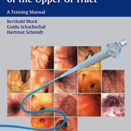 Endoscopy of the Upper GI Tract: A Training Manual