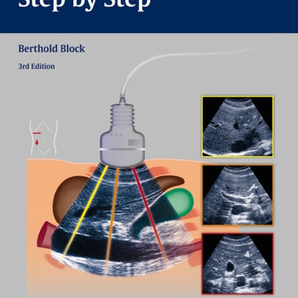 Abdominal Ultrasound: Step by Step