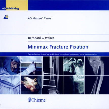 Minimax Fracture Fixation: AO Masters' Cases