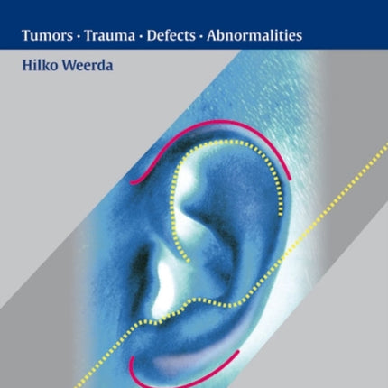 Surgery of the Auricle: