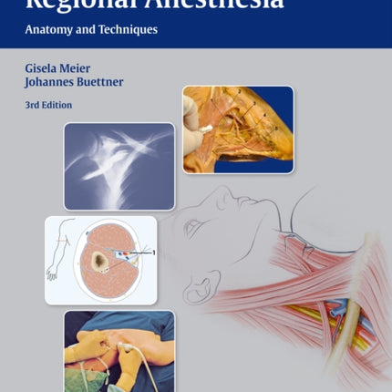 Atlas of Peripheral Regional Anesthesia: Anatomy and Techniques