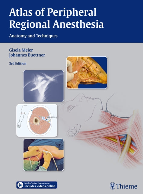 Atlas of Peripheral Regional Anesthesia: Anatomy and Techniques