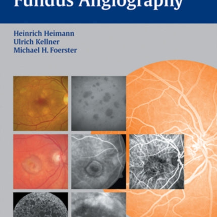 Atlas of Fundus Angiography