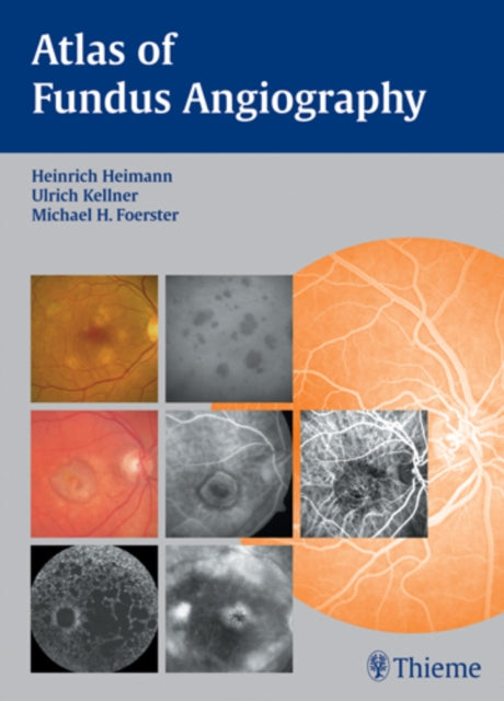 Atlas of Fundus Angiography