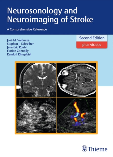 Neurosonology and Neuroimaging of Stroke: A Comprehensive Reference