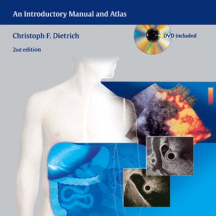 Endoscopic Ultrasound: An Introductory Manual and Atlas