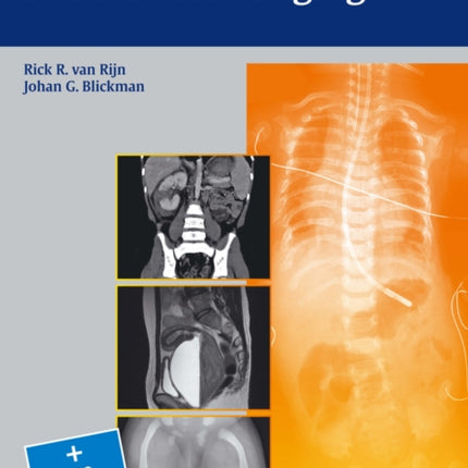 Differential Diagnosis in Pediatric Imaging