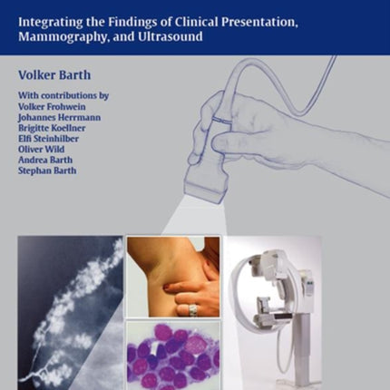 Diagnosis of Breast Diseases: Integrating the Findings of Clinical Presentation, Mammography, and Ultrasound