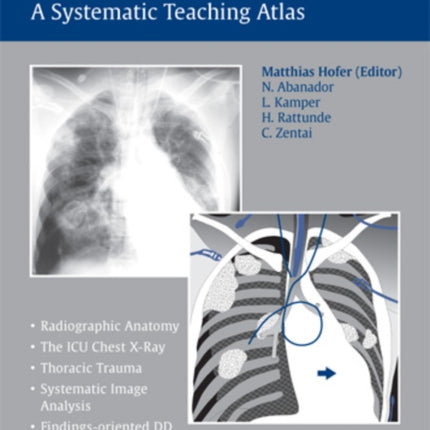 The Chest X-Ray: A Systematic Teaching Atlas