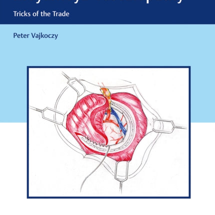 Surgical Techniques in Moyamoya Vasculopathy: Tricks of the Trade