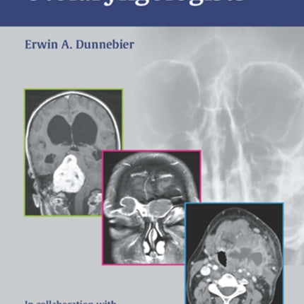 Imaging for Otolaryngologists