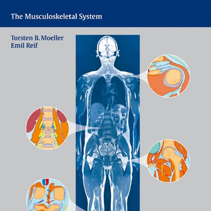 Atlas of Sectional Anatomy: The Musculoskeletal System