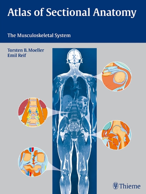 Atlas of Sectional Anatomy: The Musculoskeletal System