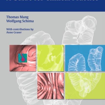 CT Colonography: A Guide for Clinical Practice